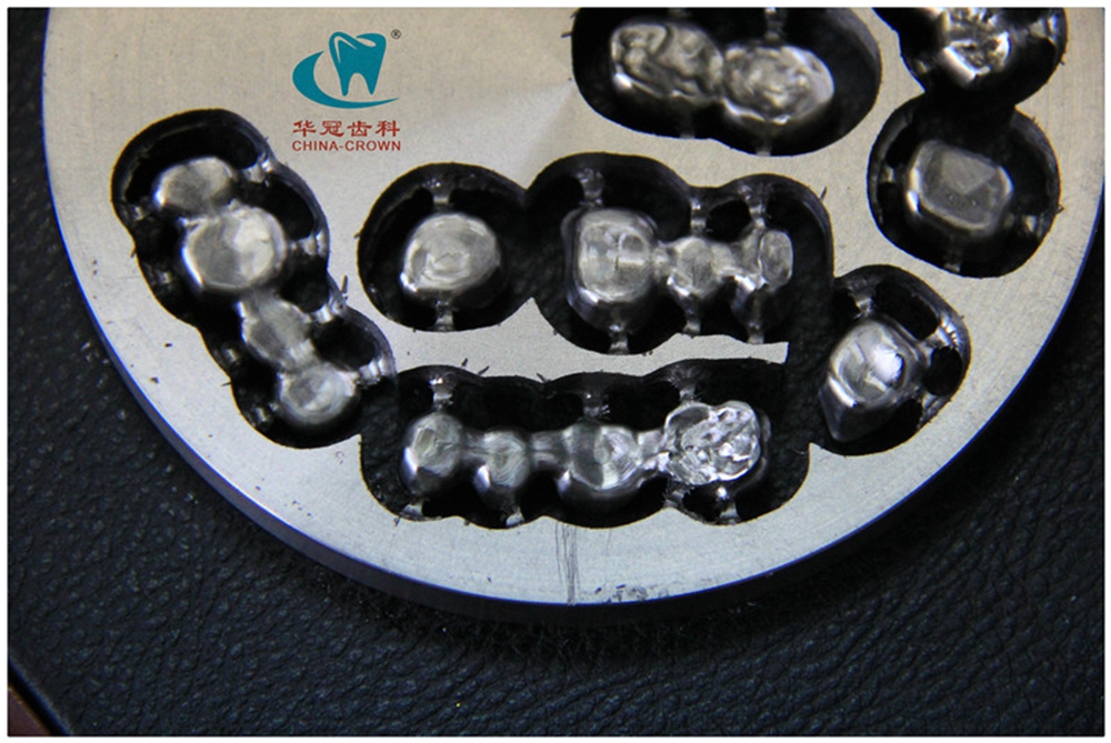 CADCAM數(shù)字純鈦金屬