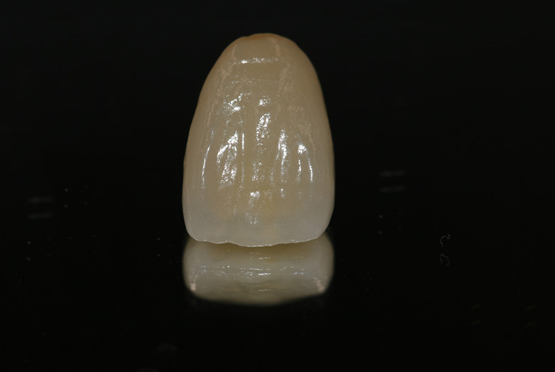 納米烤瓷牙